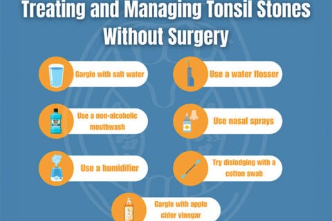 Ways of managing tonsil stones