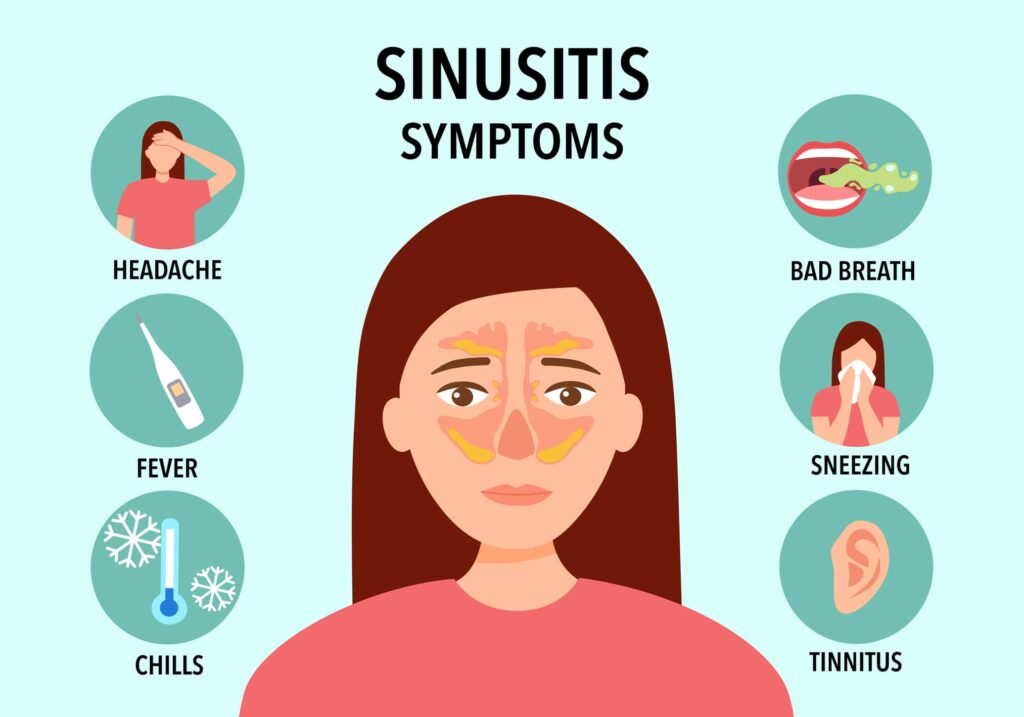 Infographic showing common sinusitis symptoms, with a focus on sinusitis in Burbank, CA.
