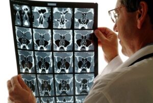 A medical professional in a white coat reviews a sinus CT scan in Burbank, CA