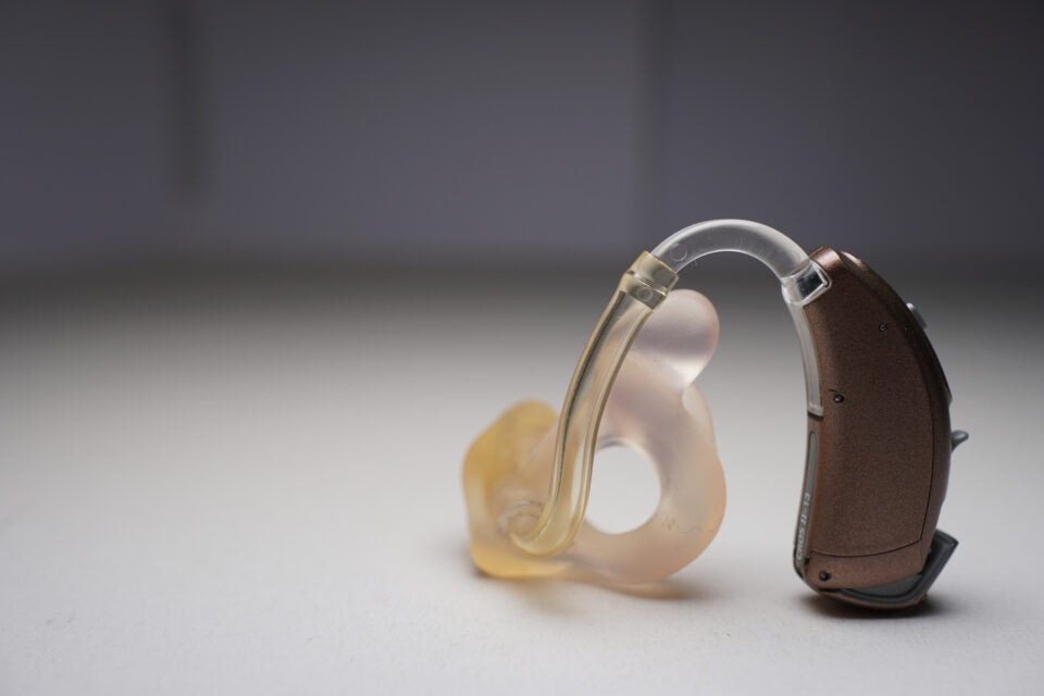 Bone-anchored hearing aid used for hearing loss treatment in Burbank, CA
